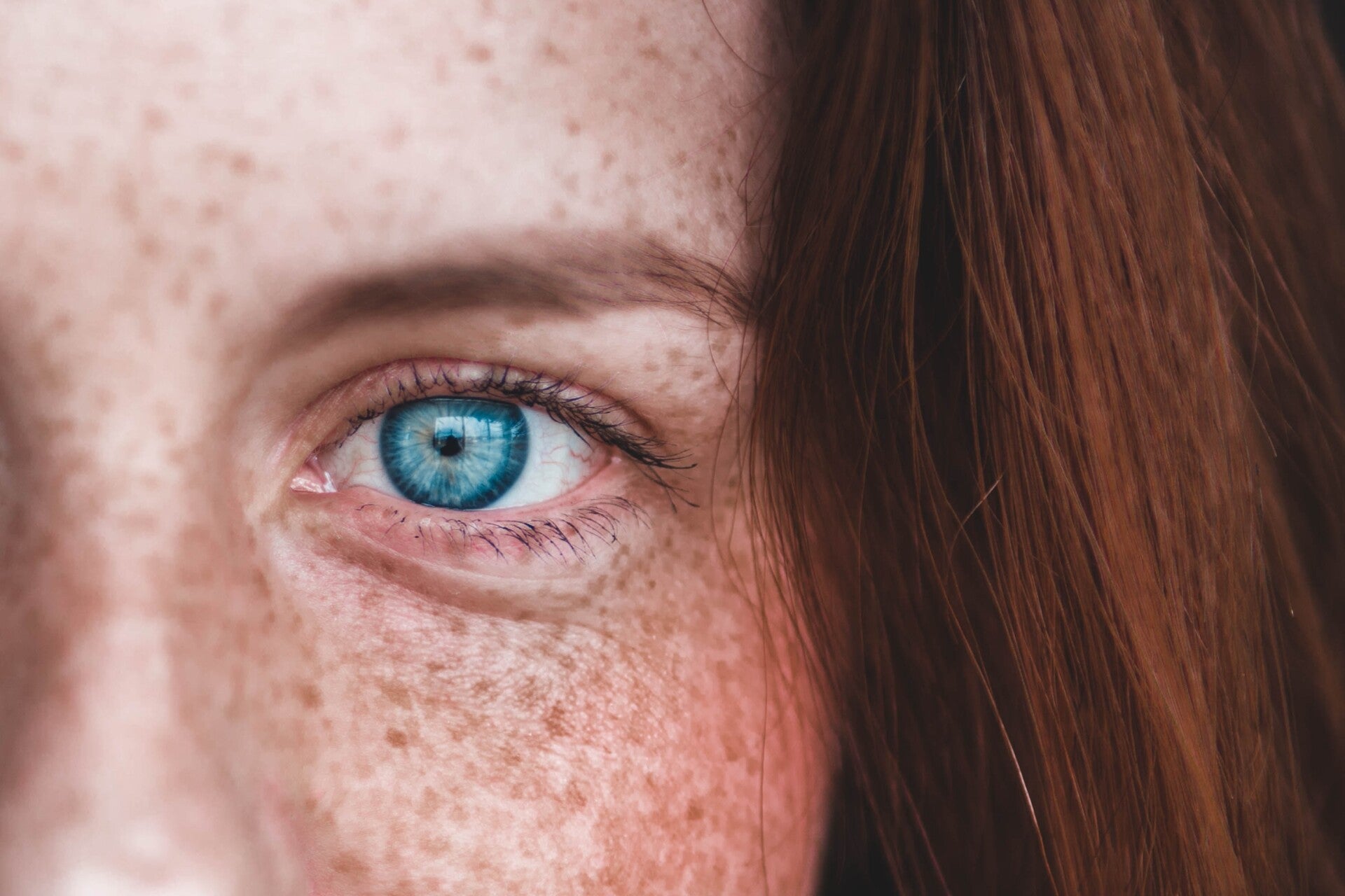 Blackcurrant Vision Supplements: Your Key to Clearer Vision and Stronger Eyes